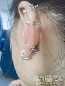 打耳洞可以吃小瓜吗